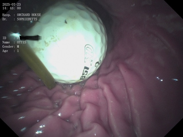 golf ball endoscopy procedure